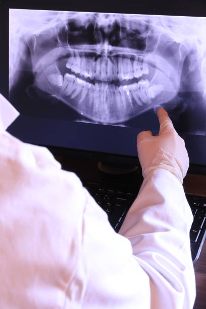 Best Emergency Tooth Extraction in Solvay, NY